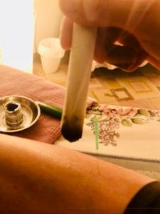 A moxa pole (shaped like a cigar) is gently warming the lower leg of a patient near an aqua handled acupuncture needle inserted into the point Zu San Li, or Stomach 36, there is a gentle golden light and the smoke from the moxa is slowly rising